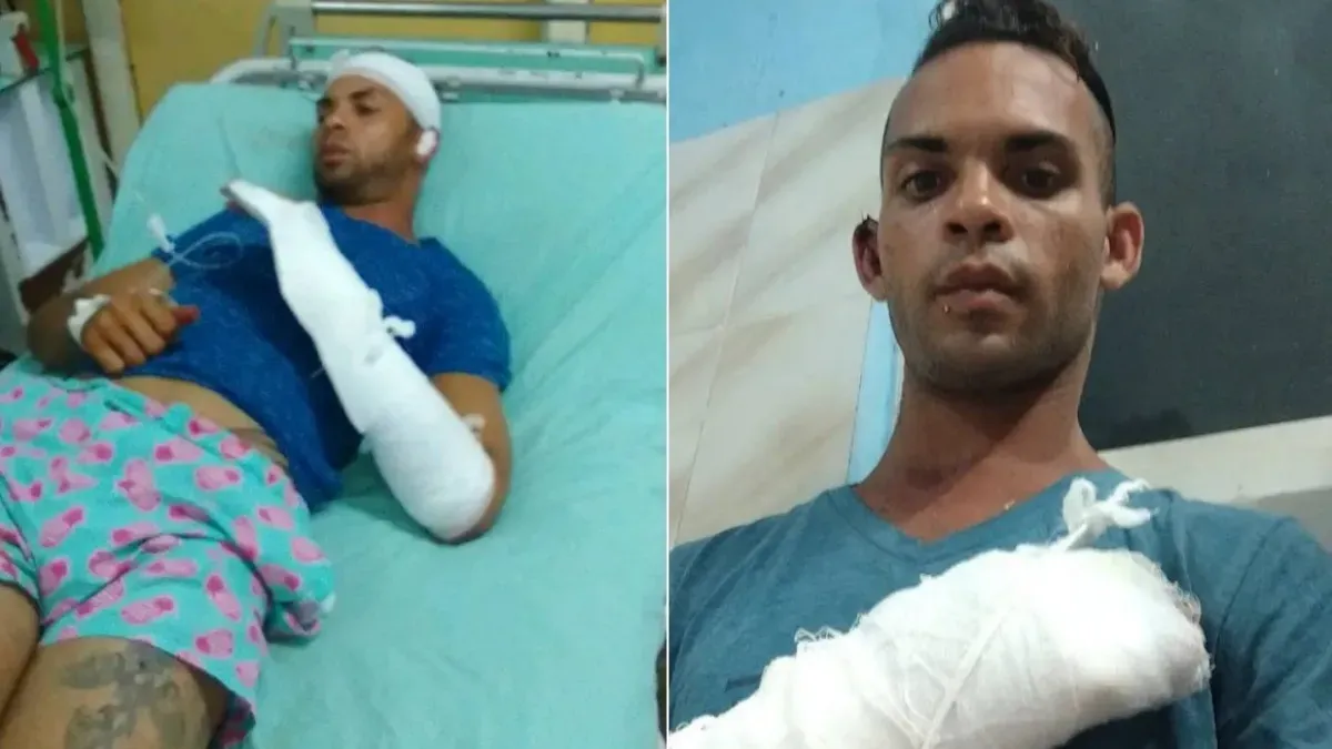 Joven cubano víctima de robo en La Habana podría perder la movilidad en ...